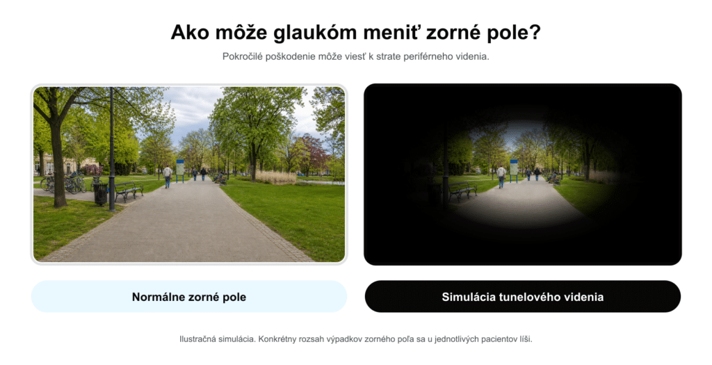 scenéria v parku pri normálnom videní vs. tunelovom videní pri glaukóme